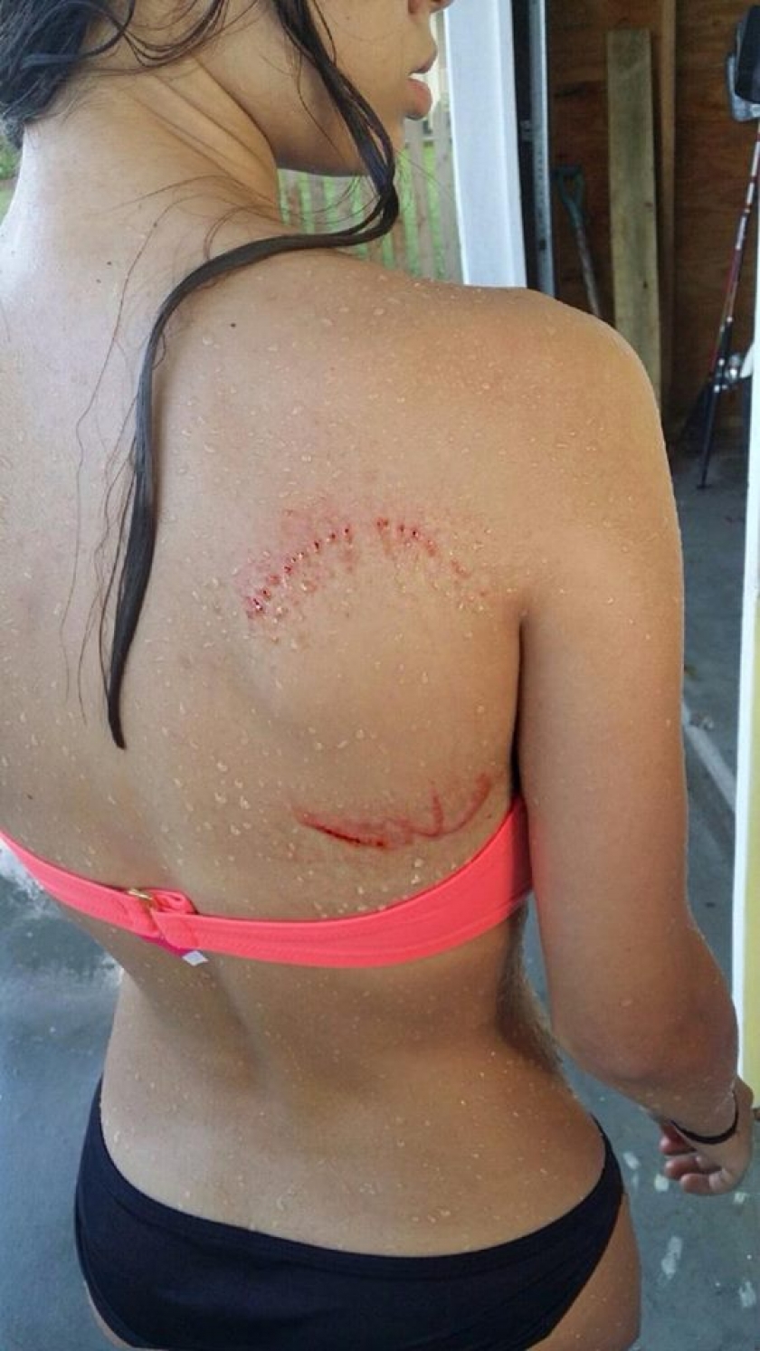 Just A Little Shark Bite