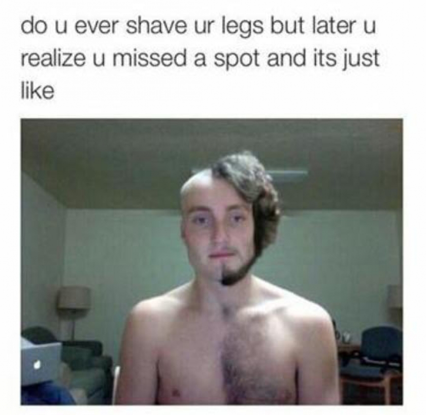 That Hairy Spot