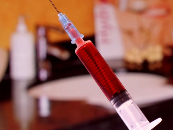 Would you ever get botox?
